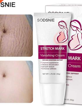 Stretch Mark Vanishing Cream Repair Anti-Wrinkle Anti-Aging