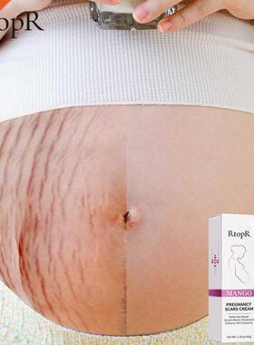 RtopR Pregnancy Scar Removal Cream Pregnant Women Pigment Co