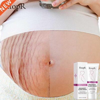 RtopR Pregnancy Scar Removal Cream Pregnant Women Pigment Co