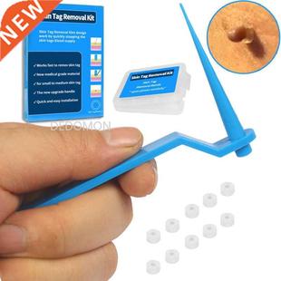 Wart Equ Tag Home Use Kit Skin Removal Remover Blue Mole Set