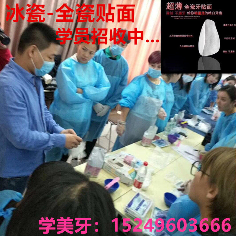 冰瓷牙 晶瓷牙 瓷贴面 牙齿贴面 冰瓷贴面 全瓷贴面 全瓷牙贴面