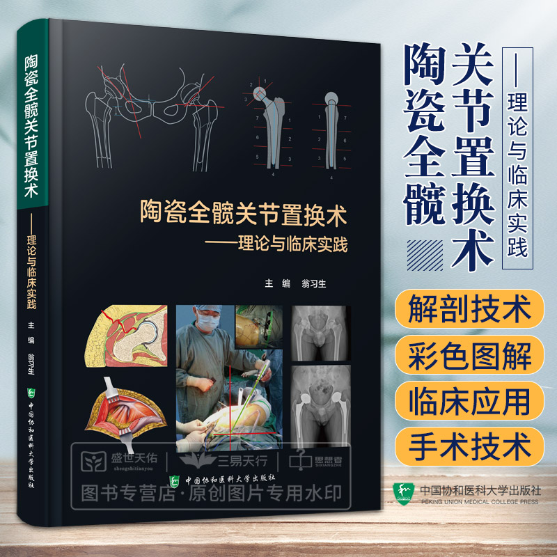 陶瓷全髋关节置换术理论