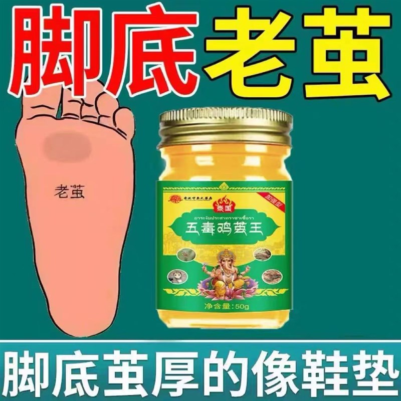 【除软化膏】去老茧脚茧关节茧手茧子脚底老茧专用脚垫脚趾厚茧去