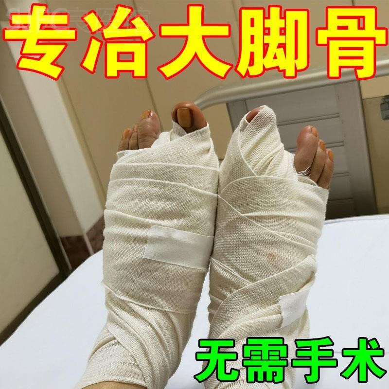 【不直包陪】大脚骨脚趾重叠专用膏贴拇外翻神器拇指外翻矫正专用