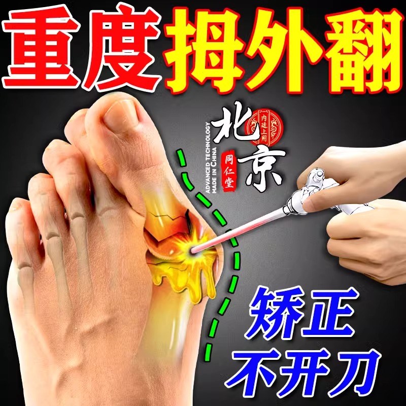 【无痛变直】拇指外翻贴脚趾重叠防磨大脚骨矫正神器外翻贴膏贴