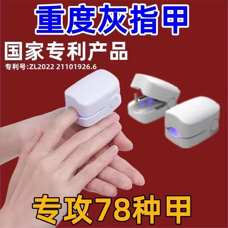 【全新技术】无痛去灰指甲严重脚指甲变色增厚紫外线光疗机灭坏甲