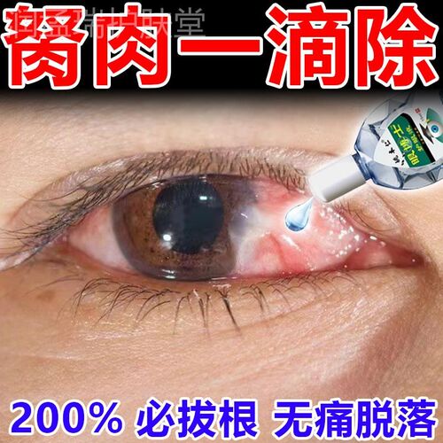 去除眼睛胬肉滴眼液眼角长翼状胬肉有异物感模糊看不清专用眼水