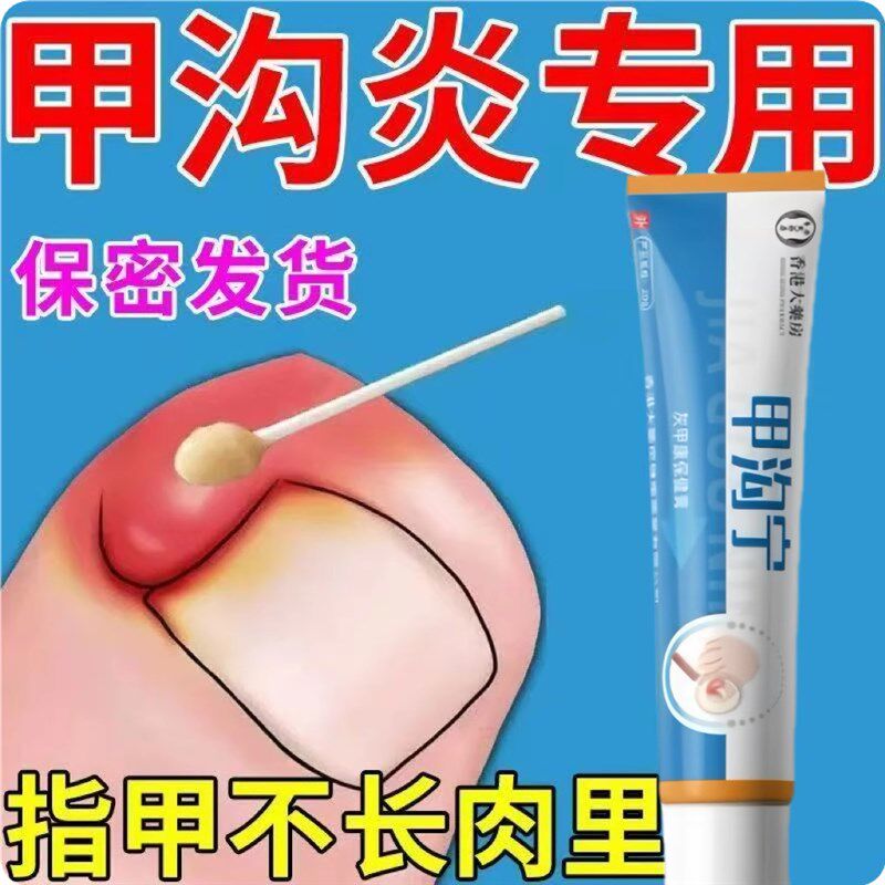 甲沟炎专用软甲嵌甲去肉芽脚趾矫正器灰指甲软化息肉抑菌去除药膏