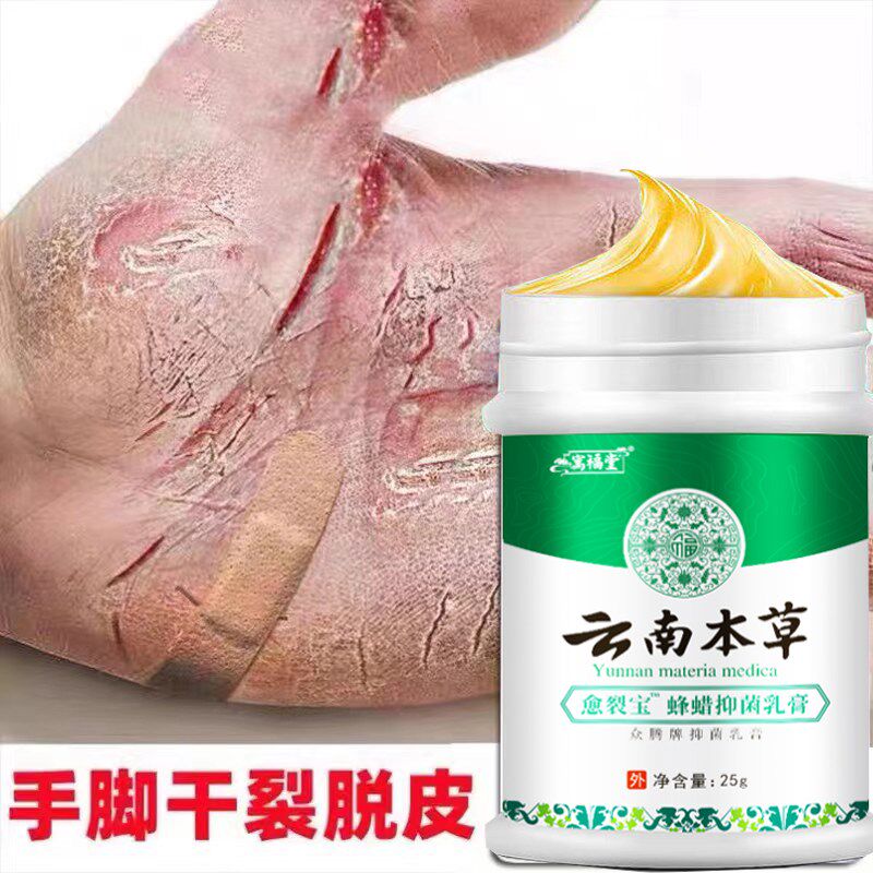治手裂的药膏防干裂手脚脱皮开裂脚后跟干裂真菌感染脚裂防裂药膏