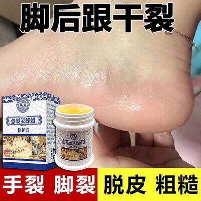 愈裂灵蜂蜡膏冬天干燥脚后跟干裂起硬皮足跟开裂干裂贴