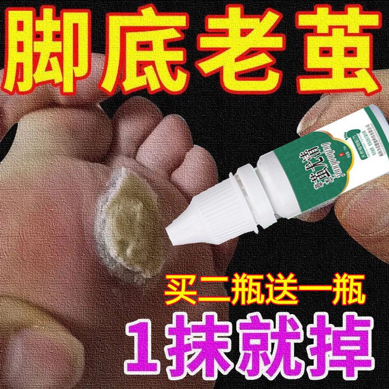 祛脚茧脚底老茧手茧祛除茧子膏专用神器死皮磨脚石神器手脚垫药