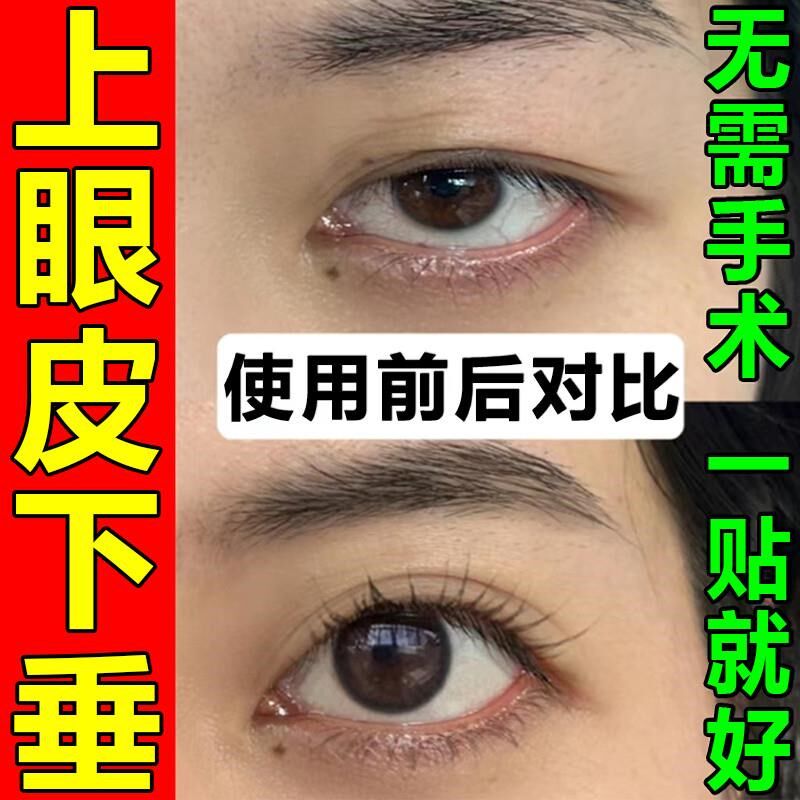 眼皮下垂提拉贴双眼皮神器去肿定型上眼睑用提拉紧致防松弛专用贴