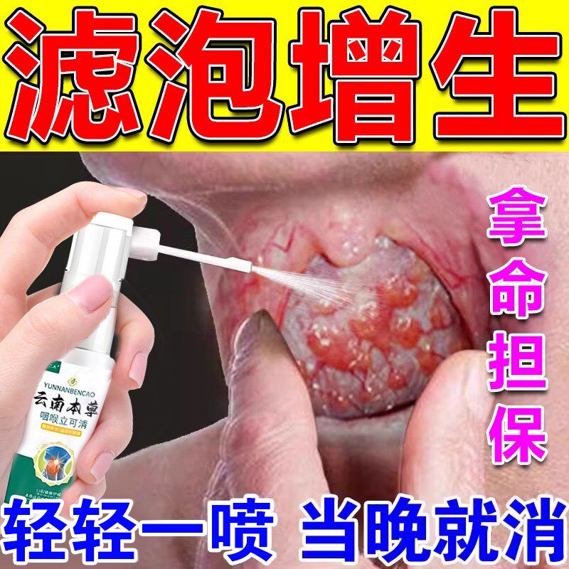 随喷随妤】喉咙滤泡增生咽喉焱淋巴滤泡舌根滤泡干痒咳嗽有异物感