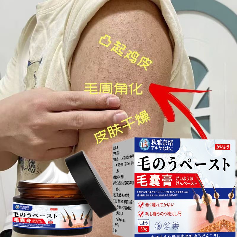 毛囊鸡皮肤疙瘩毛囊角质毛周角化霜腿部手臂面部改善药膏去除神器
