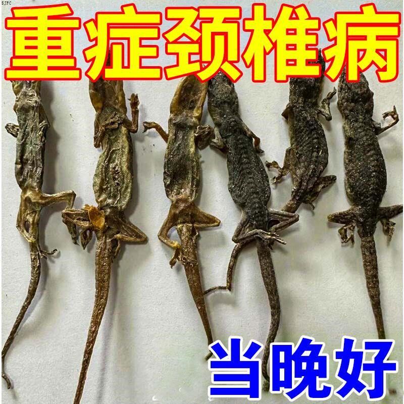 颈椎疼痛贴颈椎压迫神经脖子僵硬酸痛头晕手麻颈肩僵硬颈椎专用贴