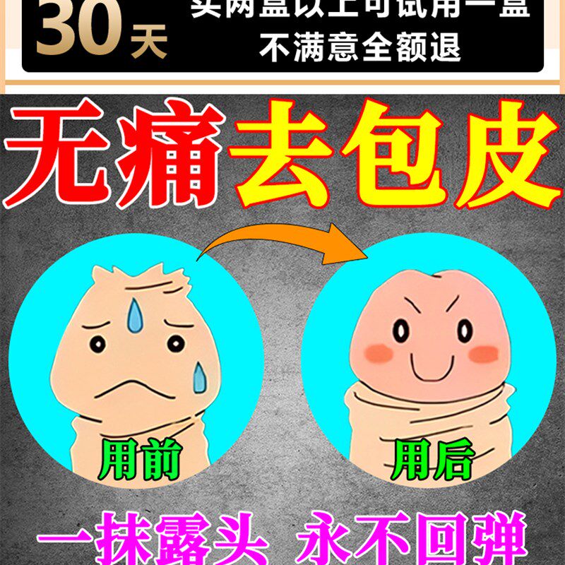 包皮过长环切除器自己割自动脱落包皮过长修覆收缩矫正男用隐形SX
