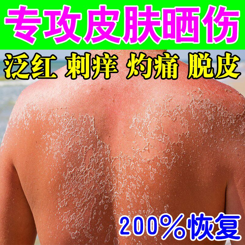 后背皮肤晒伤修复户外爆晒脱皮发红刺痒疼痛水泡太阳晒伤专用防晒