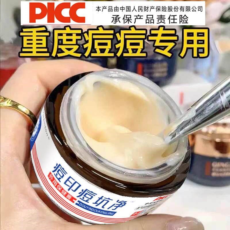 香港九龙中医研究-草本痘痘修护B痘印痘坑痘疤青春痘