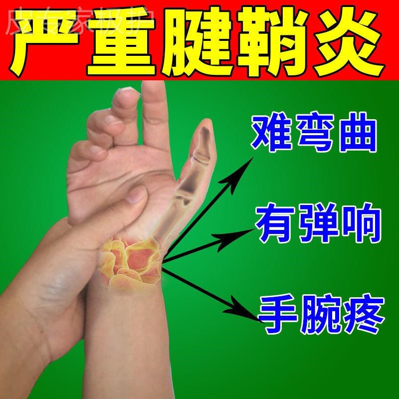 腱鞘炎专用【一抹好手腕中指大拇指伸屈困难弹响腱鞘馕肿鼓包专用