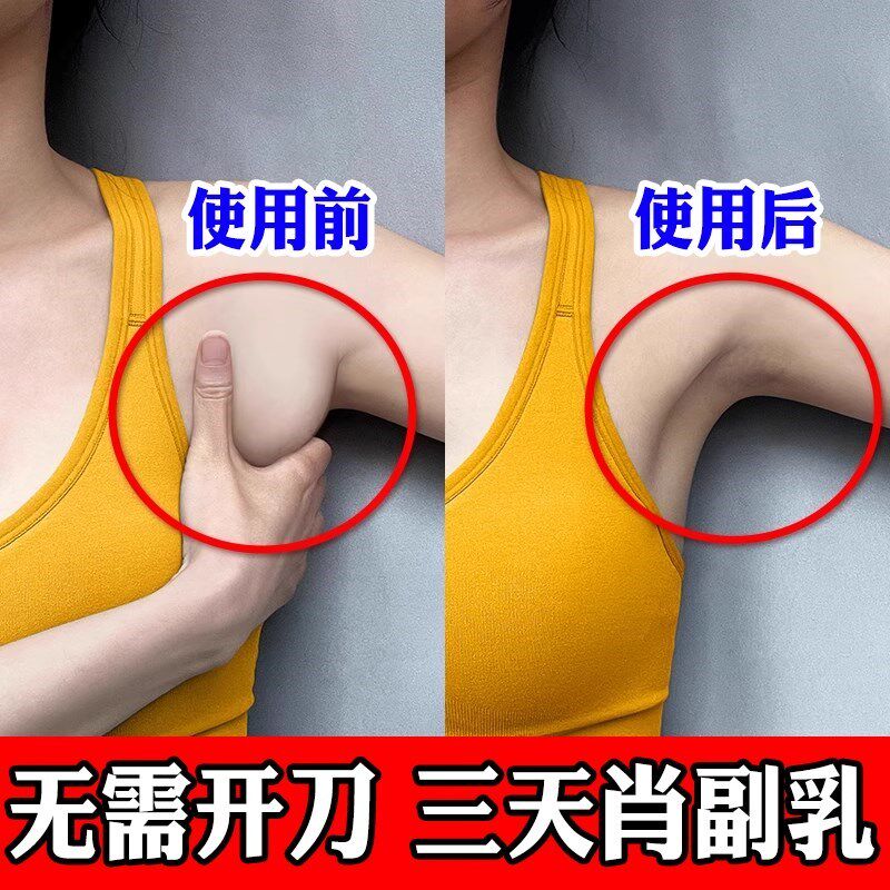 副乳贴去副乳神器【最慢3天收副乳】腋下淋巴疏通专用膏药贴