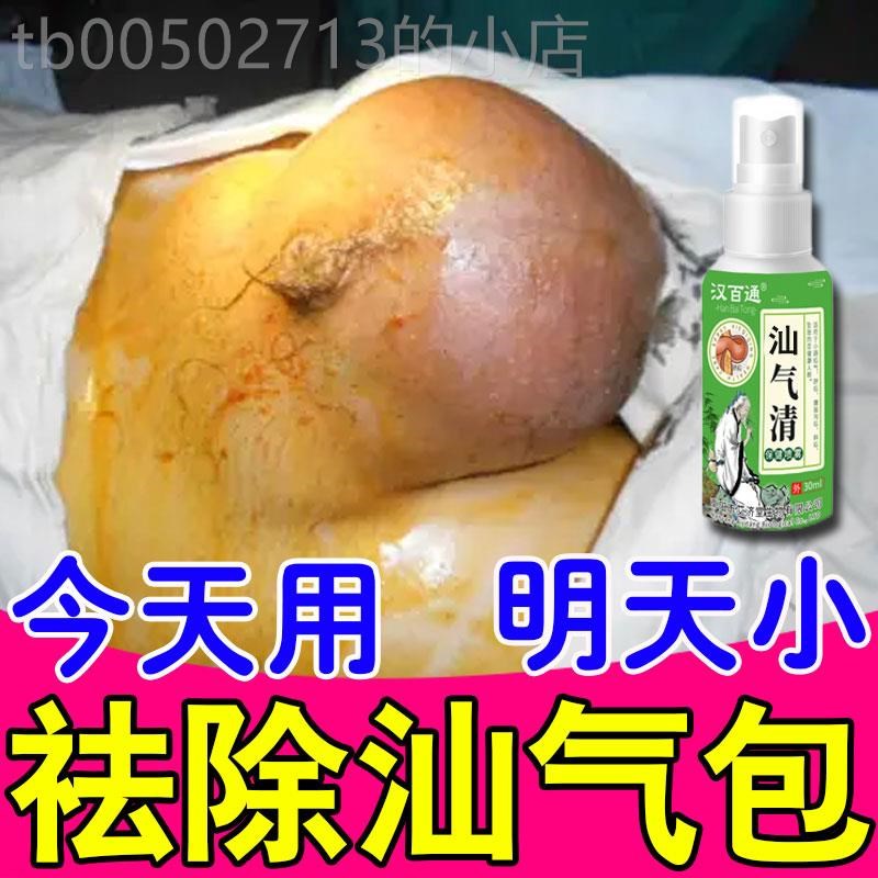 【一喷疝气消】中老年腹股沟小肠疝气贴婴儿肚脐直斜疝消鼓包膏药
