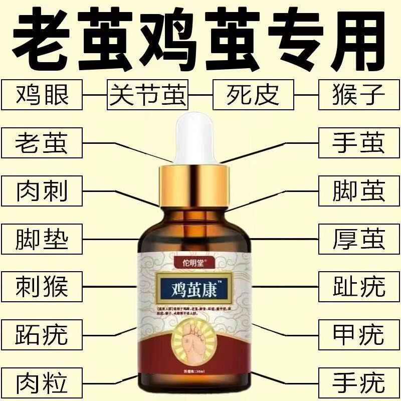 去老茧脚垫手茧关节茧脚底脚掌死皮厚茧脚后跟硬皮足部去茧精华液
