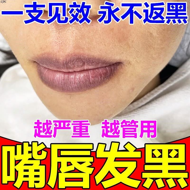 嘴角发黑去除嘴巴周边改善唇周黑唇角暗沉淡化唇色唇纹