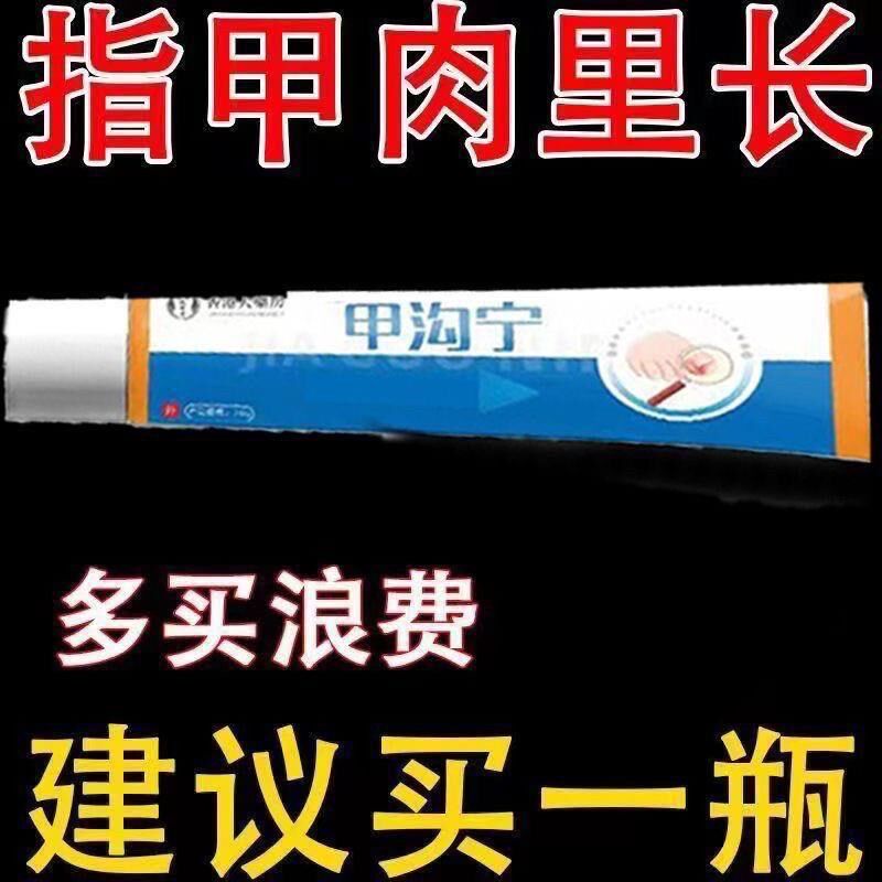 甲沟炎专用软甲嵌甲去肉芽脚趾矫正器灰指甲软化息肉抑菌去除药膏