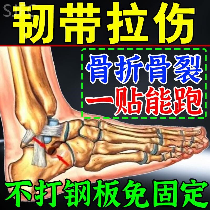 韧带拉伤恢复贴脚踝手腕膝盖红肿疼痛骨折骨裂小腿肌肉撕裂扭伤药