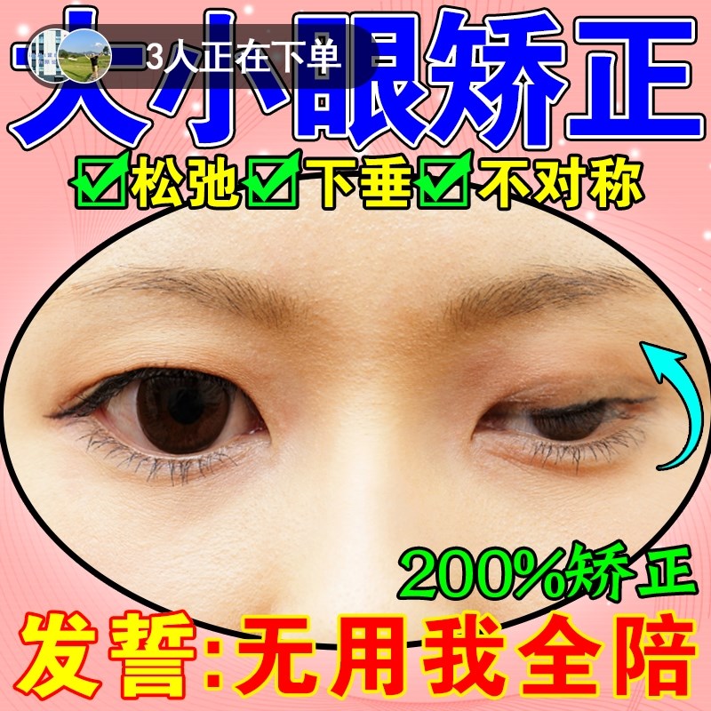 大小眼矫正器眼皮松弛提拉紧致下垂双眼皮神器眼睛肌无力眼脸肿贴