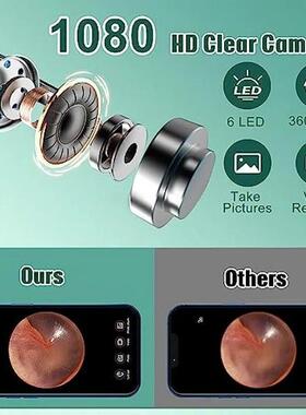 WIFI camera earwax remover N30 Pro with 6 LEDs, 1080P high-d