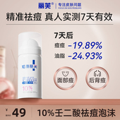 丽芙10%壬二酸泡沫百分之10壬二酸泡沫去祛痘痘黑头闭口粉刺