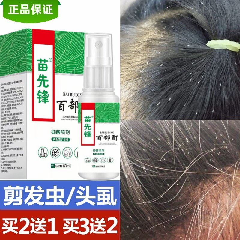 除剪发虫螨虫卷发虫小女孩头上长虱子药的药治儿童头痒白点点专用