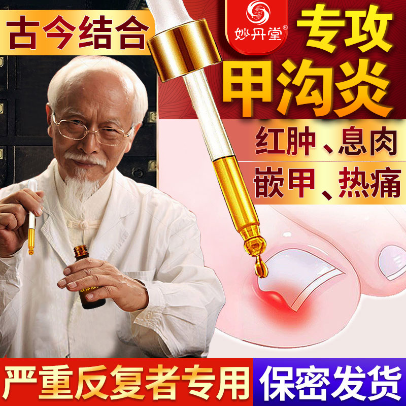 甲沟炎灰指甲杀菌止痒
