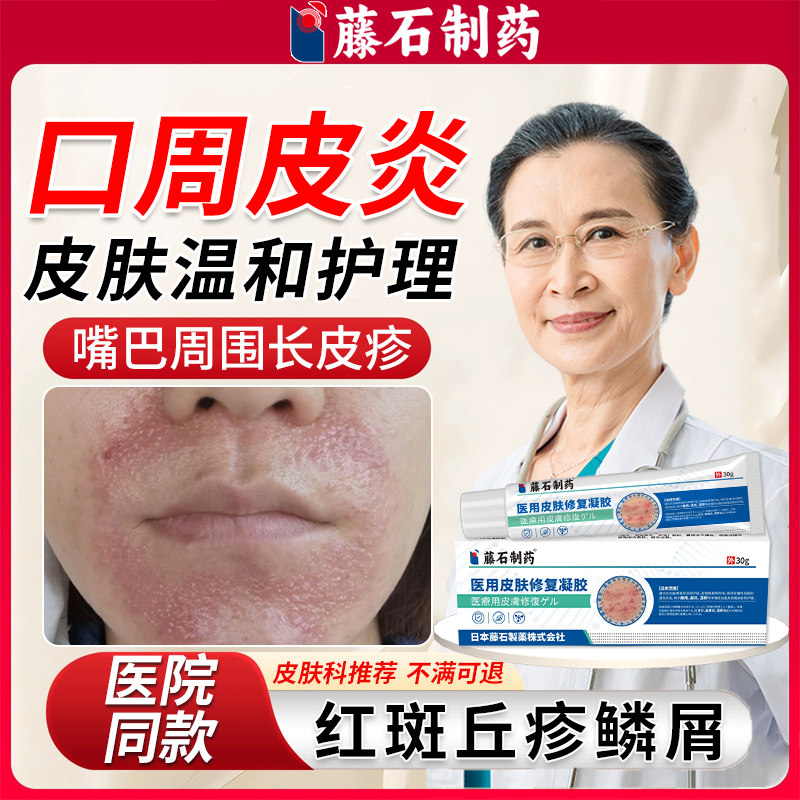 口周皮炎嘴巴周围红斑丘疹瘙痒过敏起皮专用唇周炎药房同款膏WQ