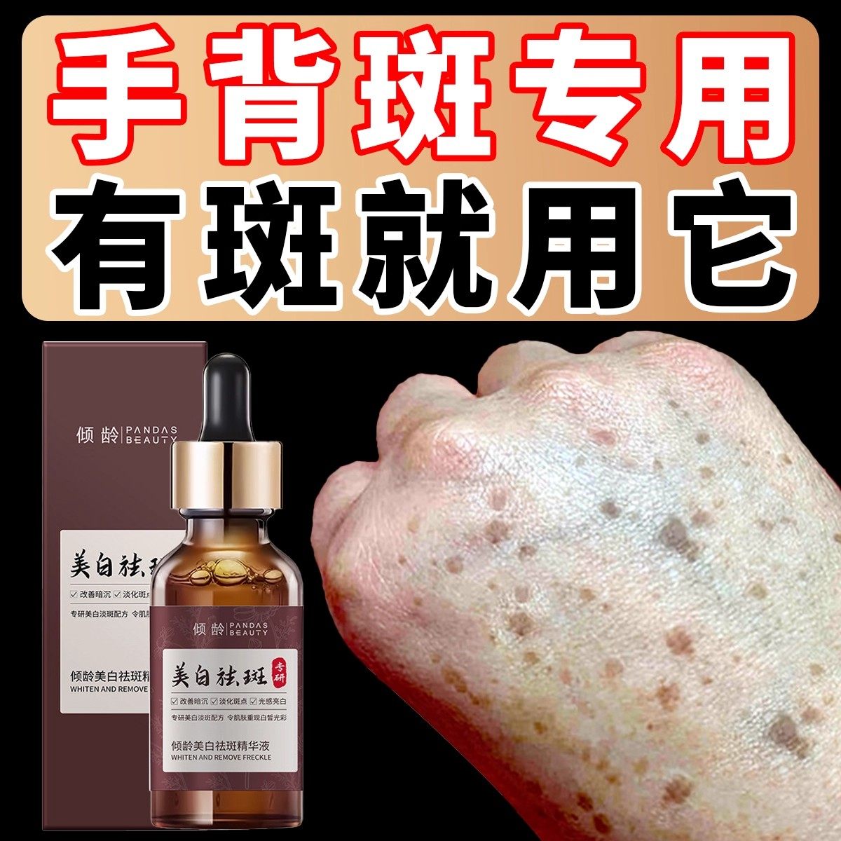 祛斑黄褐雀官方正品专用水
