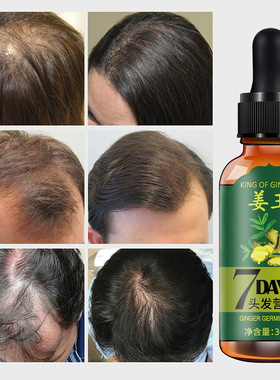 7days GINGER GERMINAL OIL