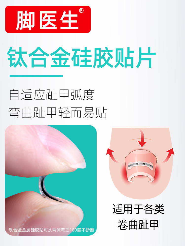 脚医生正甲贴甲沟嵌甲炎拉拉脚指甲趾甲专用矫正器纠正贴片长肉里