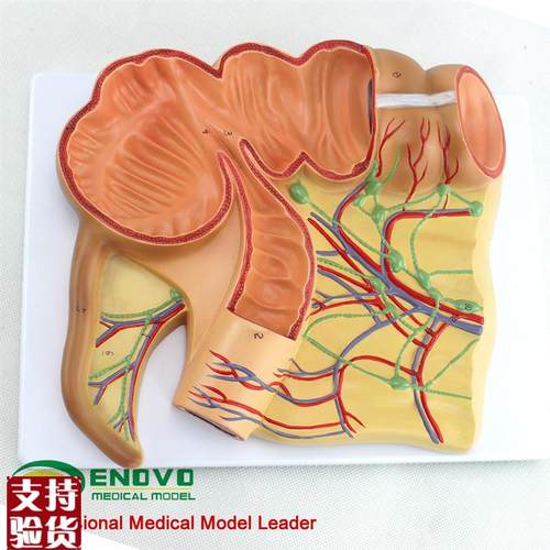 ENOVO颐g诺人体医学回盲部解剖模型盲肠阑尾升结回肠血管淋巴模型