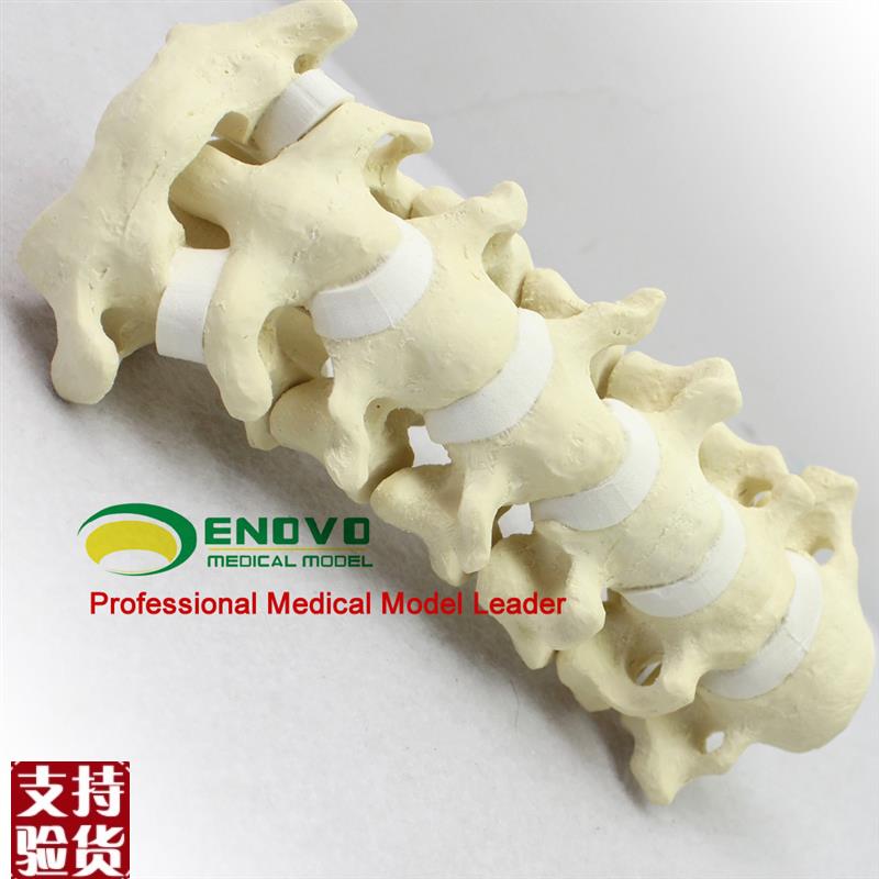 ENOVO颐诺骨科仿真人体颈椎模型医学骨科手术T仿真骨颈椎前路后