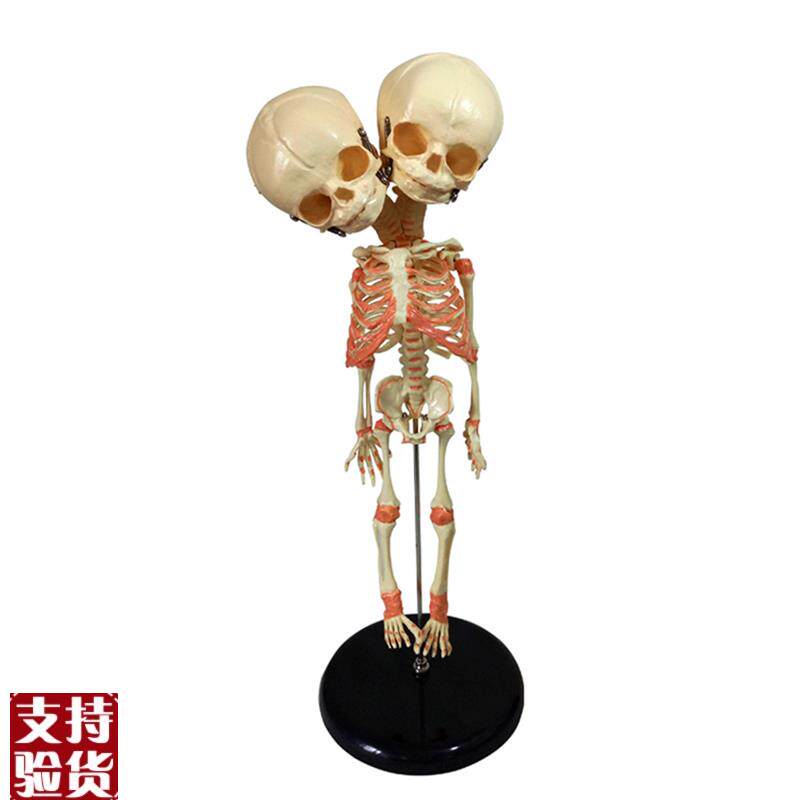 婴儿骷髅模型双头婴儿畸形骨骼x骨架人骨素描人体教学医用教仪35C