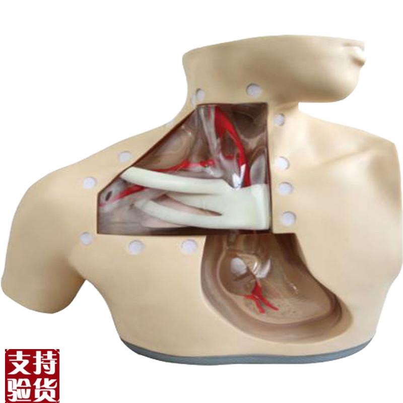 高级肠外营养护理模H型H72护理模型