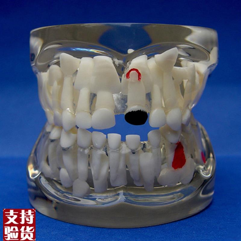 ENOVO颐诺儿童乳牙早期病态牙列模型牙齿发P育幼儿牙齿护理教学具