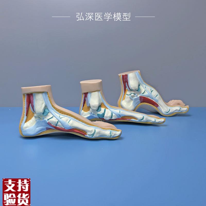 正常足扁平足弓型足模型脚解剖人体脚部构M结构造肌肉血管医学模