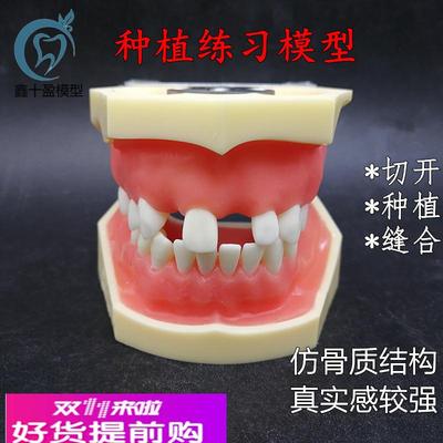 牙科种植上下缺失练习切开种植缝合仿骨质牙齿模型上颌窦提升术