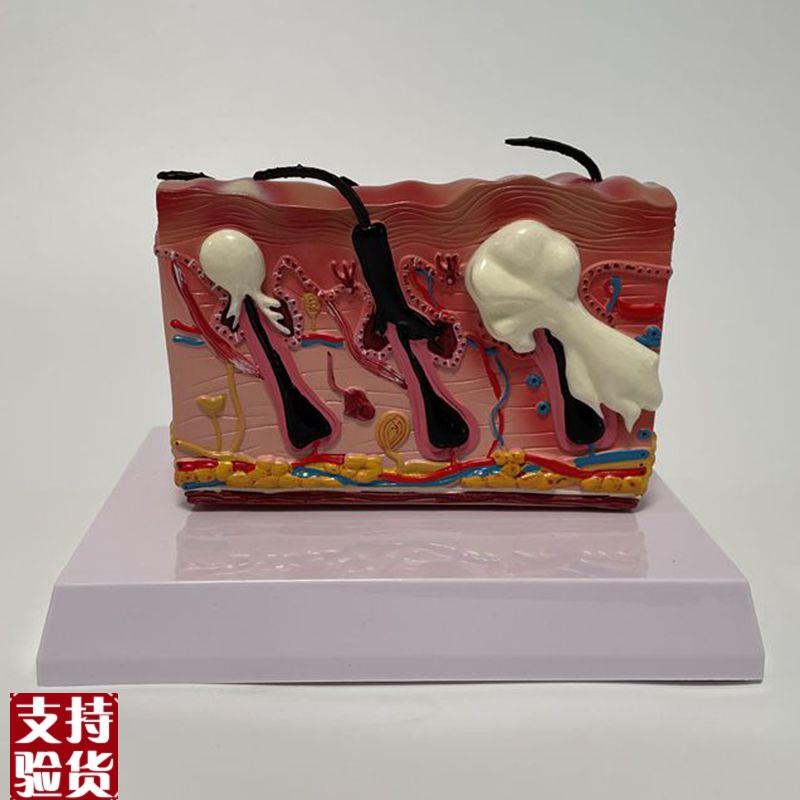 康泰医学模型人体k皮肤痤疮青春痘毛囊皮脂腺粉刺丘疹脓疱黑头粉