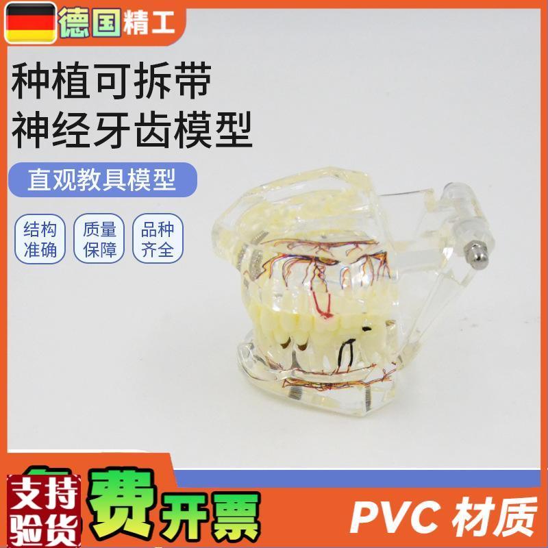 德国】PNT-hOR16口腔牙科种植可拆带神经牙齿模型可拆卸口腔修复