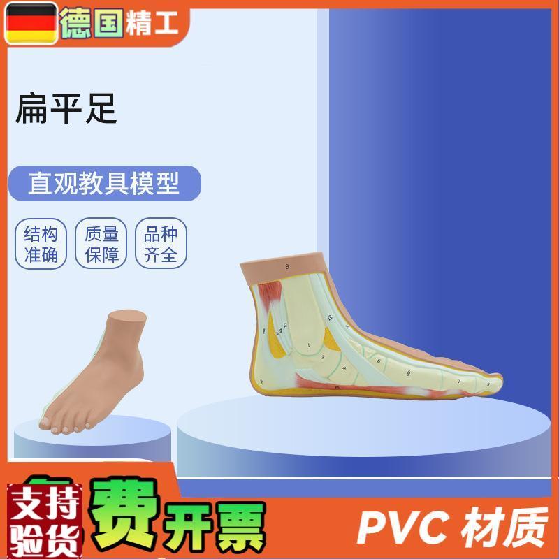德国】PNT-0728扁平足直观教具G平底足弓塌陷模型脚关节解剖模