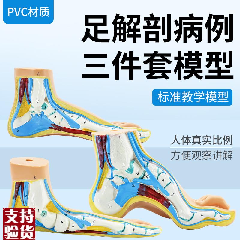 正常足扁平足弓形m足模型/足弓模型解剖模型脚模型教学模型