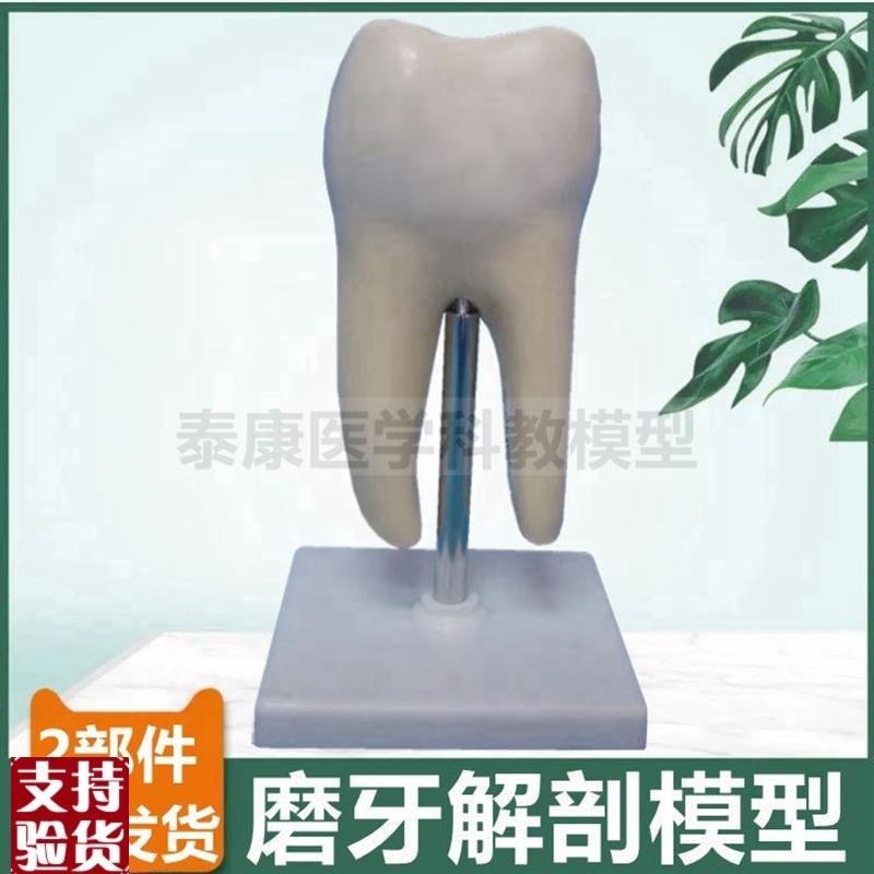 大型磨牙模型臼齿结m构可拆卸蛀牙病理口腔牙科摆件牙医考试用模